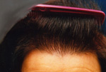 Female Hair example 3 after